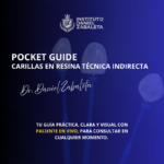 Curso online Carillas en Resina Técnica Indirecta (Pocket Guide)